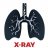 Х-Ray